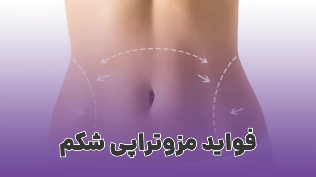 مزوتراپی برای چربی سوزی شکم