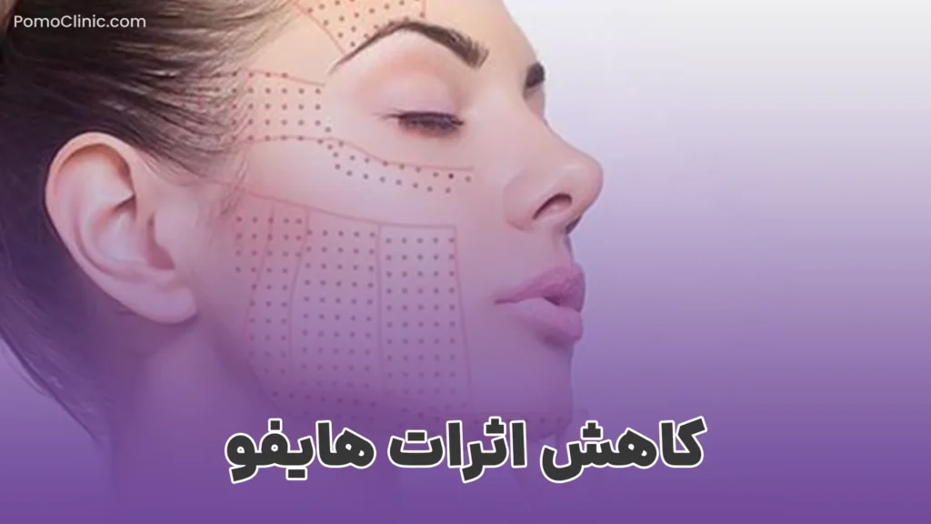 عوارض هایفوتراپی صورت