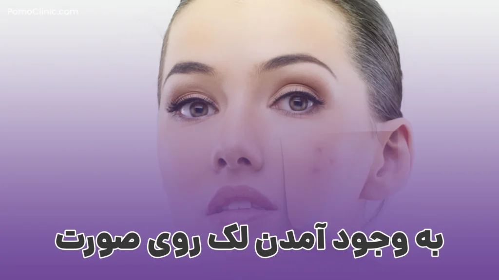 عوارض هایفوتراپی صورت