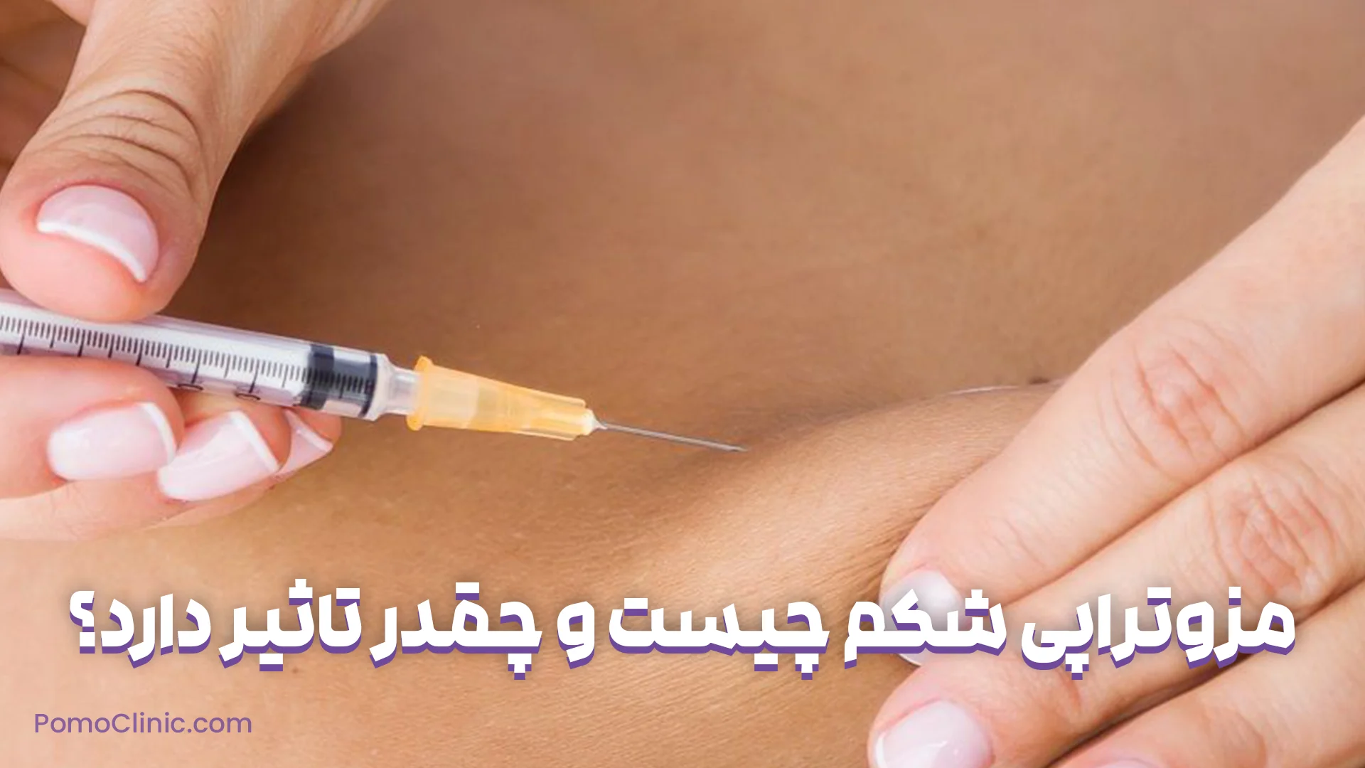 مزوتراپی شکم چیست و چقدر تاثیر دارد؟