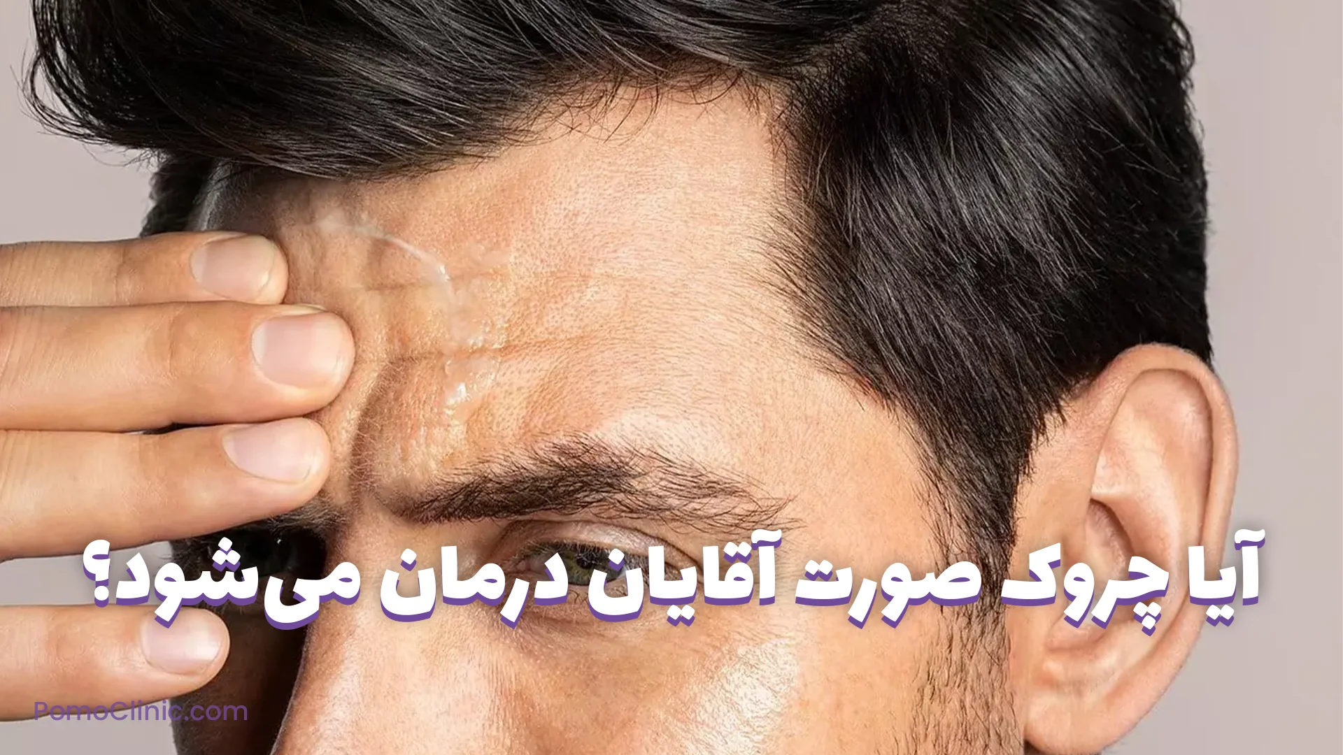 آیا چروک صورت آقایان درمان می‌شود؟