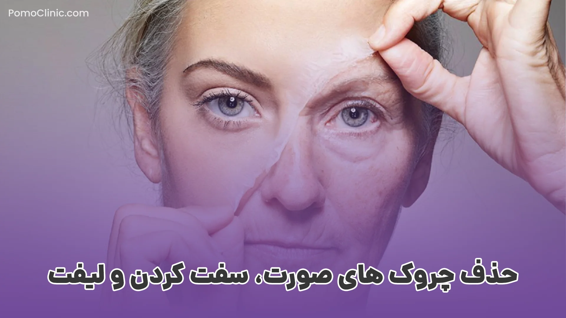 حذف چروک های صورت، سفت کردن و لیفت