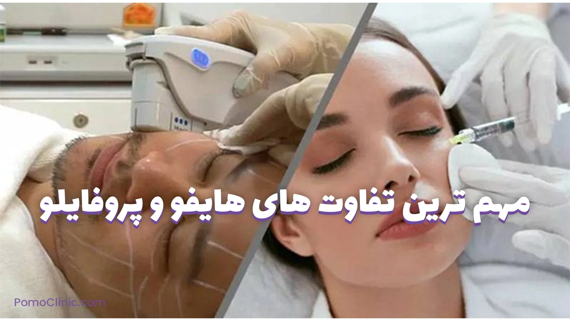 مهم ترین تفاوت های هایفو و پروفایلو