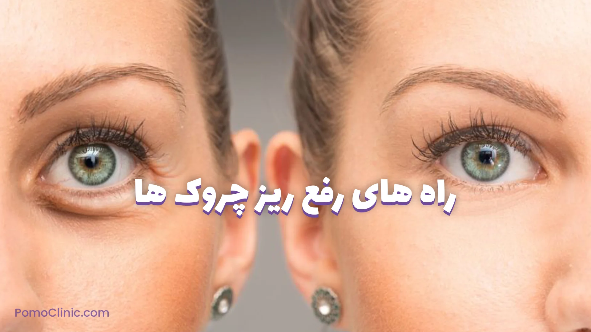 راه های رفع ریز چروک ها