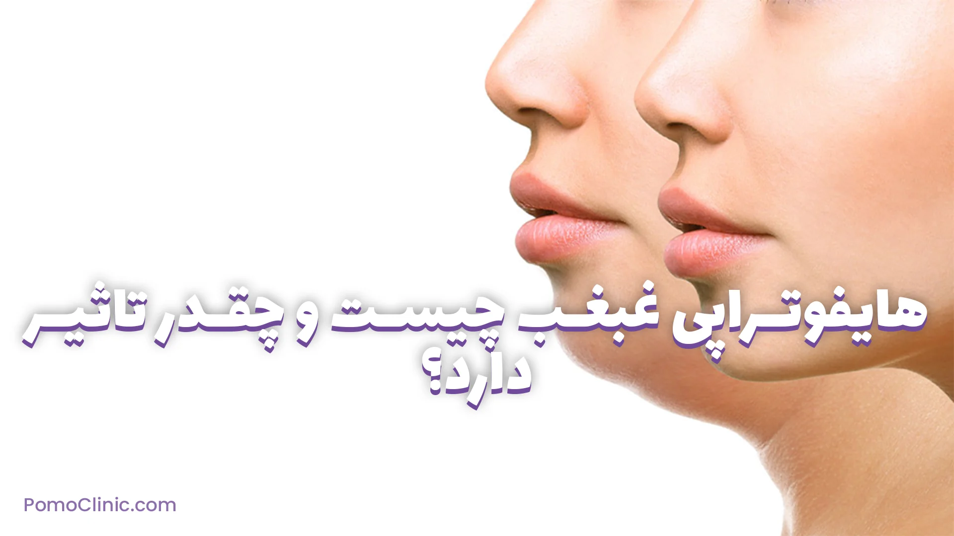 هایفوتراپی غبغب چیست و چقدر تاثیر دارد؟